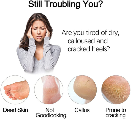 Electric Foot Grinder Vacuum Foot Grinding Machine Exfoliating Dead Skin Callus Remover Foot Care